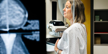 Enhanced breast cancer screening in the UK could detect an extra 3,500 cancers per year, trial shows