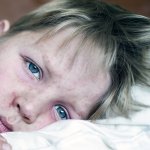 Very sick 5 year old little boy fighting measles infection, boy is laying in bed under the blanket with an agonizing expression, boy is covered with rash caused by virus.
